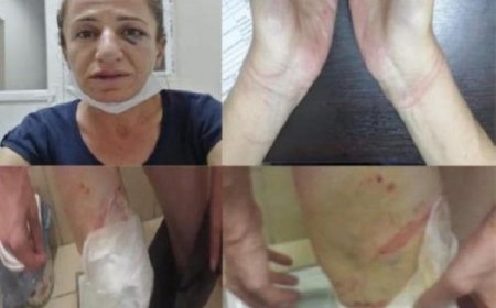 İşkence ve Kötü Muamele İddiaları Hakkında