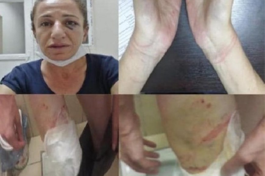 İşkence ve Kötü Muamele İddiaları Hakkında