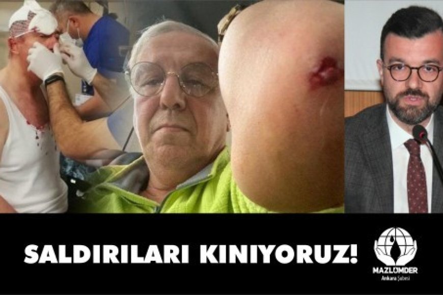 SALDIRILAR KABUL EDİLEMEZ!