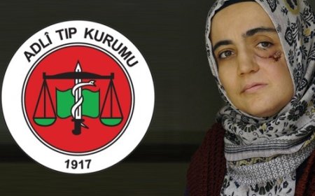 Ayşe Özdoğan Özelinde Türkiye’de Hasta Mahpuslar Meselesi, Adli Tıp Kurumu ve İnfaz Erteleme Uygulaması