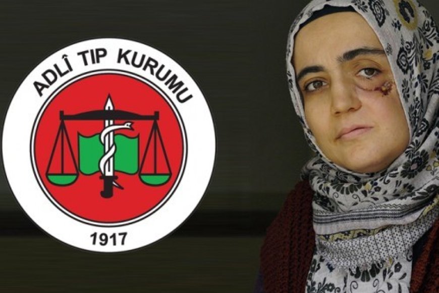 Ayşe Özdoğan Özelinde Türkiye’de Hasta Mahpuslar Meselesi, Adli Tıp Kurumu ve İnfaz Erteleme Uygulaması