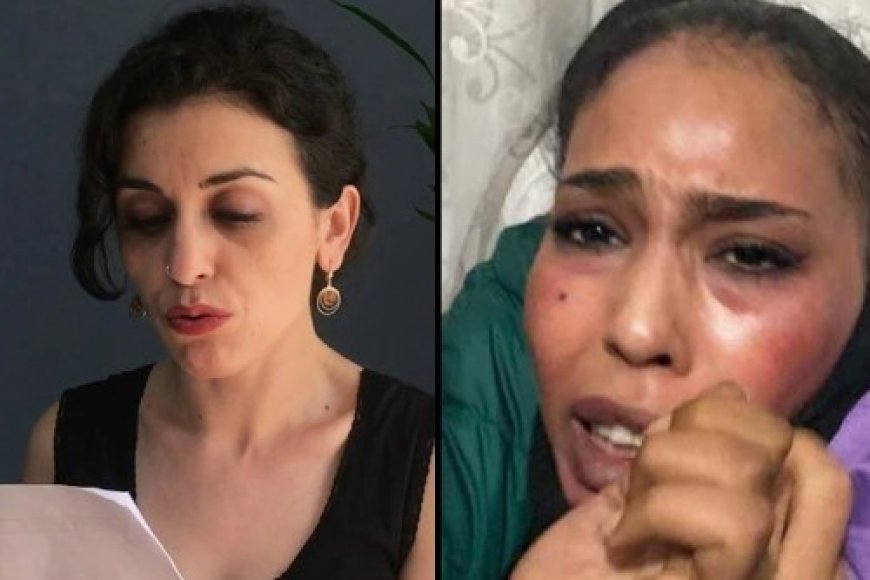 İstiklal Caddesi Saldırısından Sonra Yaşanan Hukuksuzluklar Kabul Edilemez